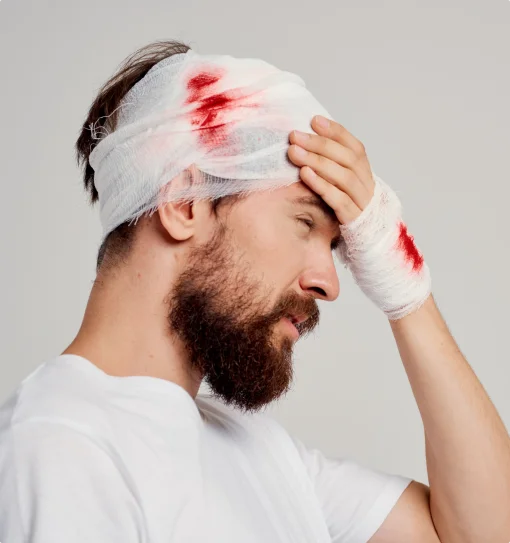 Traumatic Brain Injury Attorney In California