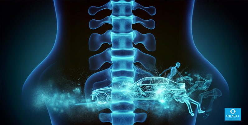 Illustration of spinal injuries in a rear end collision