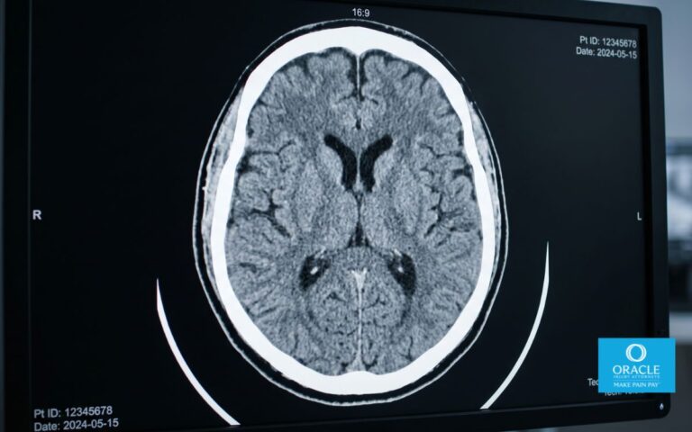 Brain Injuries After Car Accidents